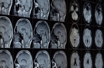 Our Brains Include Lithium—and Its Loss May Assist Drive Alzheimer’s, Research Finds