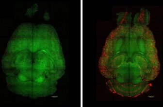 Scientists Simply Reversed Alzheimer’s in Mice. May They Do It in People?